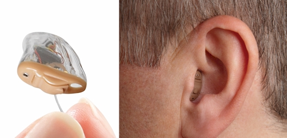 Hearing Aids for Tinnitus – Do They Work Effectively?